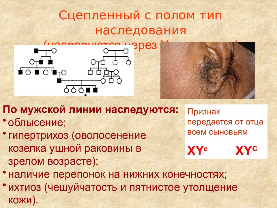 Гипертрихоз наследуется как доминантный признак