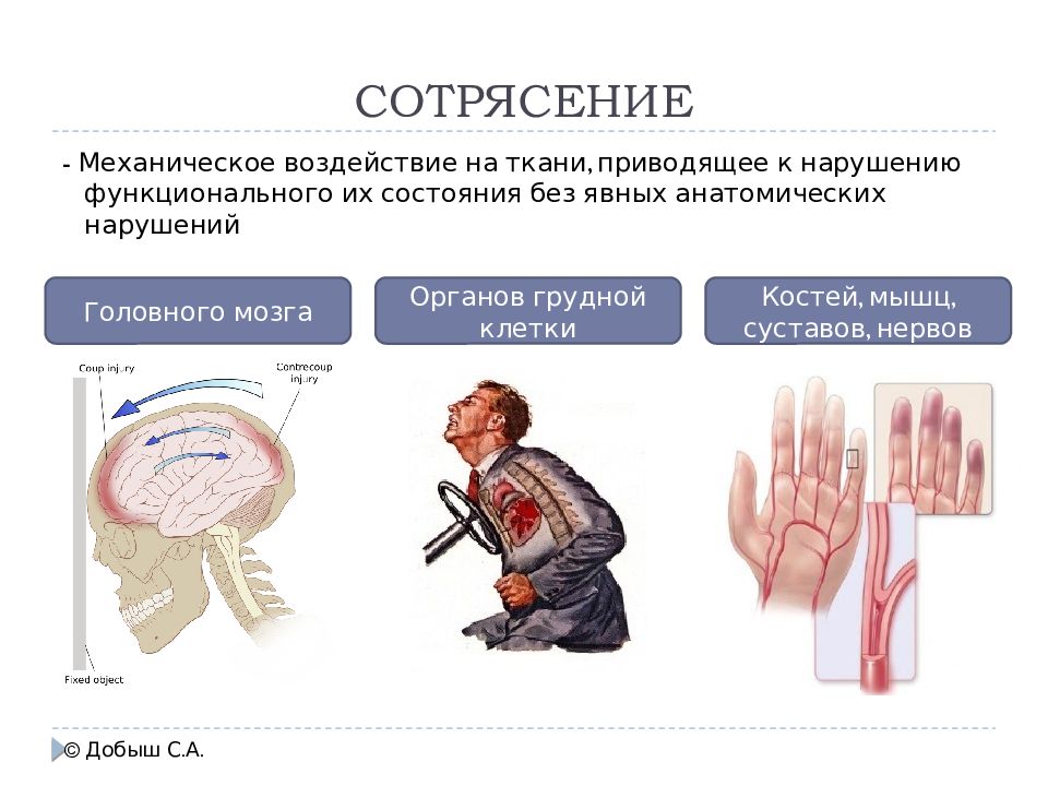 Сдавление грудной клетки картинки