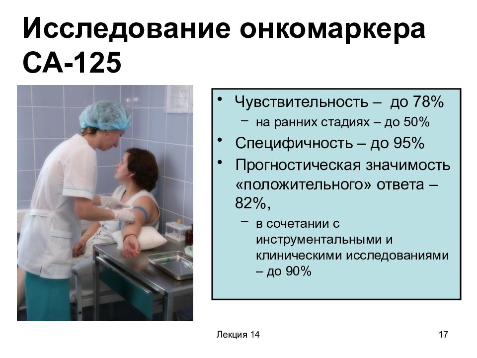 Са 125 онкомаркер у женщин