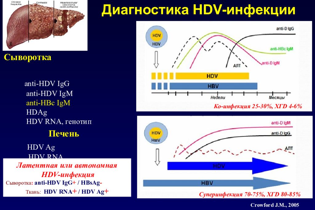 Hbc гепатит. Анти HBC. Анти HBC ig. Анти Hdv и анти HBC IGM. IGG-кассета (анти-человеческий глобулин / анти-IGG).