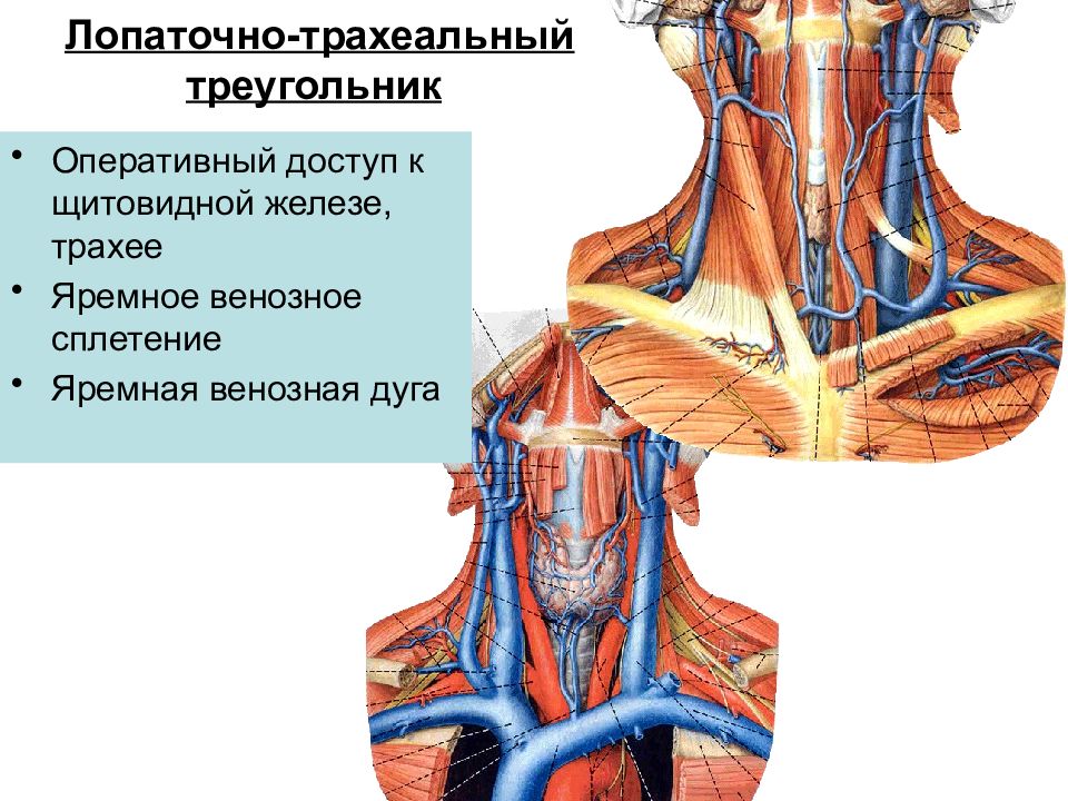 Наружная яремная вена схема