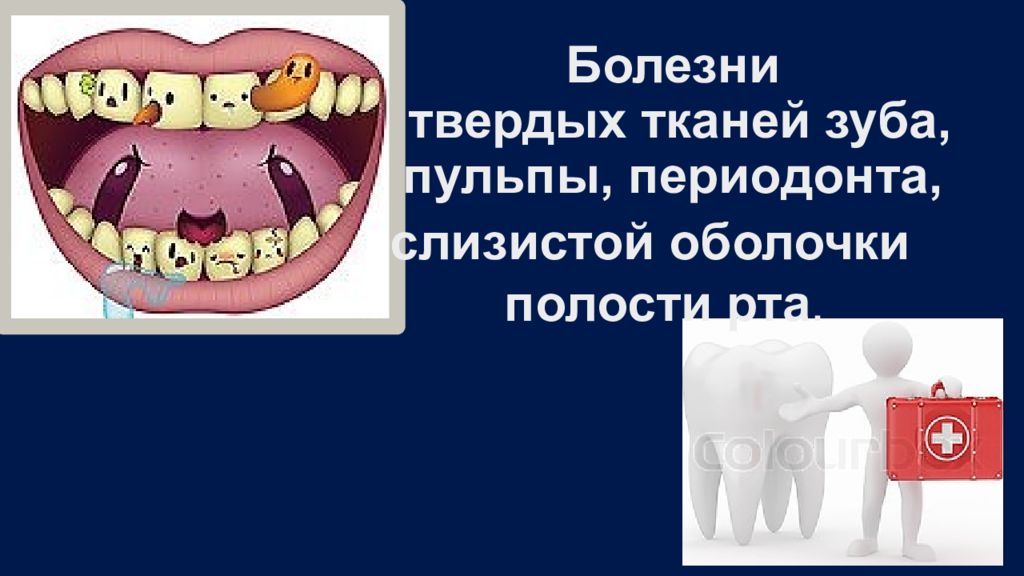 Болезни твердых тканей зуба, пульпы, периодонта,