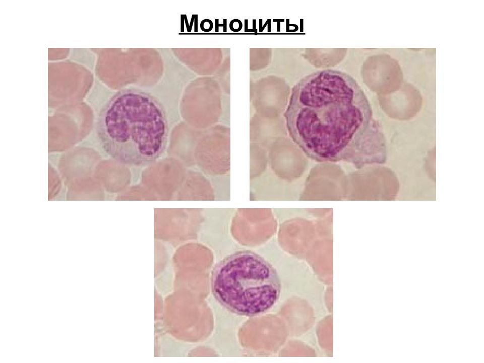 Моноциты в крови картинки