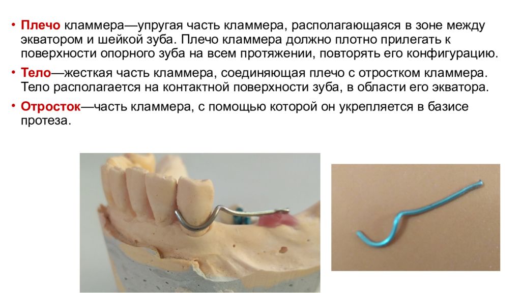 Показания к пластиночным протезам. Требования, предъявляемые к опорным зубам. Показания к изготовлению искусственных коронок. Требования к частичным съемным пластиночным протезам.