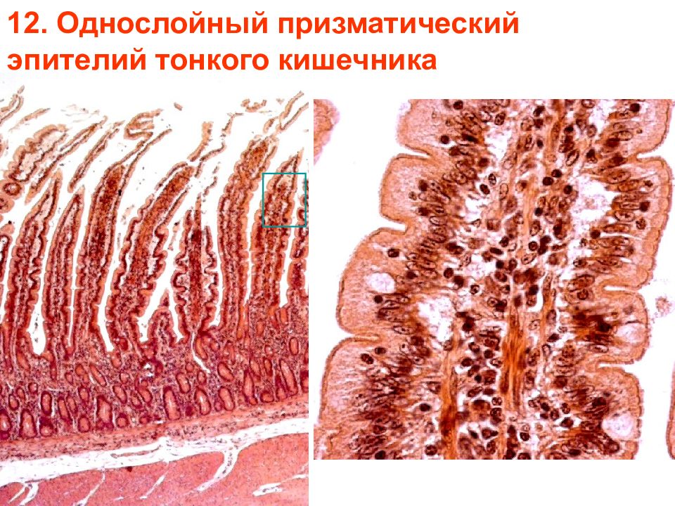 Эпителий кишечника. Однослойный призматический каемчатый эпителий тонкой кишки препарат. Однослойный призматический эпителий гистология. Однослойный однорядный призматический железистый эпителий. Однослойный призматический эпителий толстой кишки гистология.