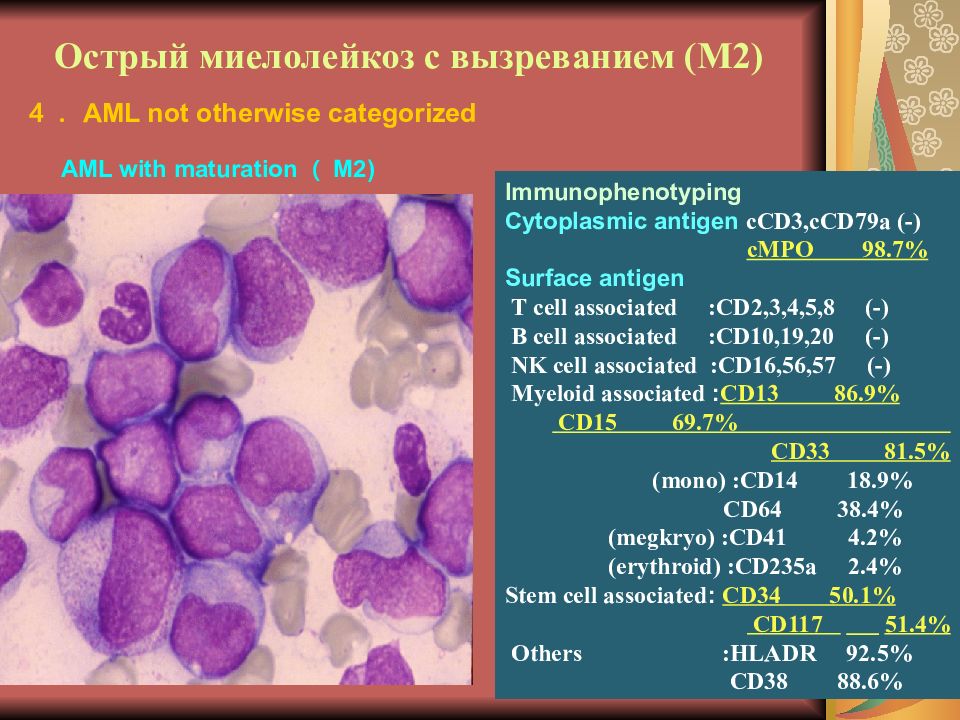 Острый миелобластный лейкоз фото
