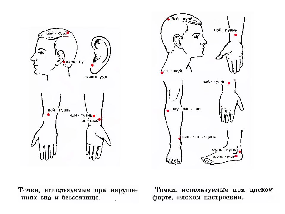 Точка использование. Точечный массаж при бессоннице точки. Массаж при бессоннице точки. Точечный массаж при бессоннице. Точки акупунктуры при нарушении сна.