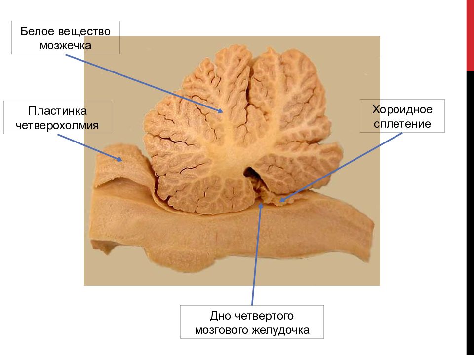 Ткань мозжечка. Мозжечок препарат анатомия. Червь мозжечка анатомия. Белое вещество мозжечка анатомия. Ядра мозжечка анатомия.