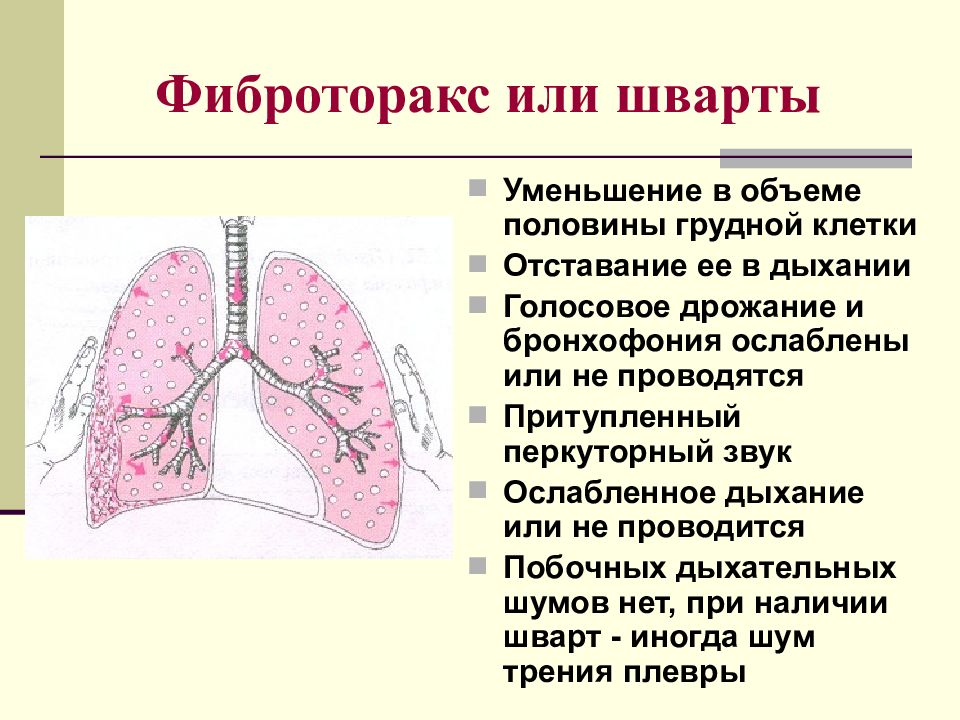 Презентация пропедевтика внутренних болезней дыхательная система