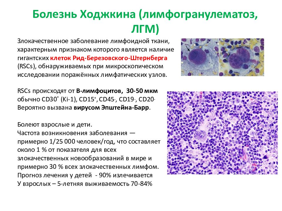 Лимфогранулематоз онкология презентация
