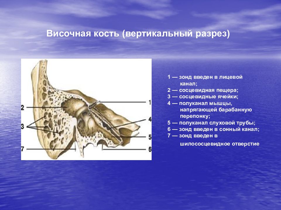 Канал кости. Сосцевидная пещера височной кости. Височная кость барабанная полость. Полуканал слуховой трубы височная кость. Височная кость в разрезе.