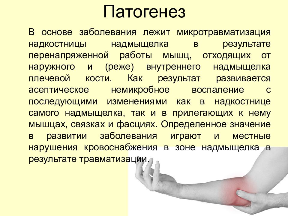 Профессиональные болезни опорно двигательного аппарата презентация