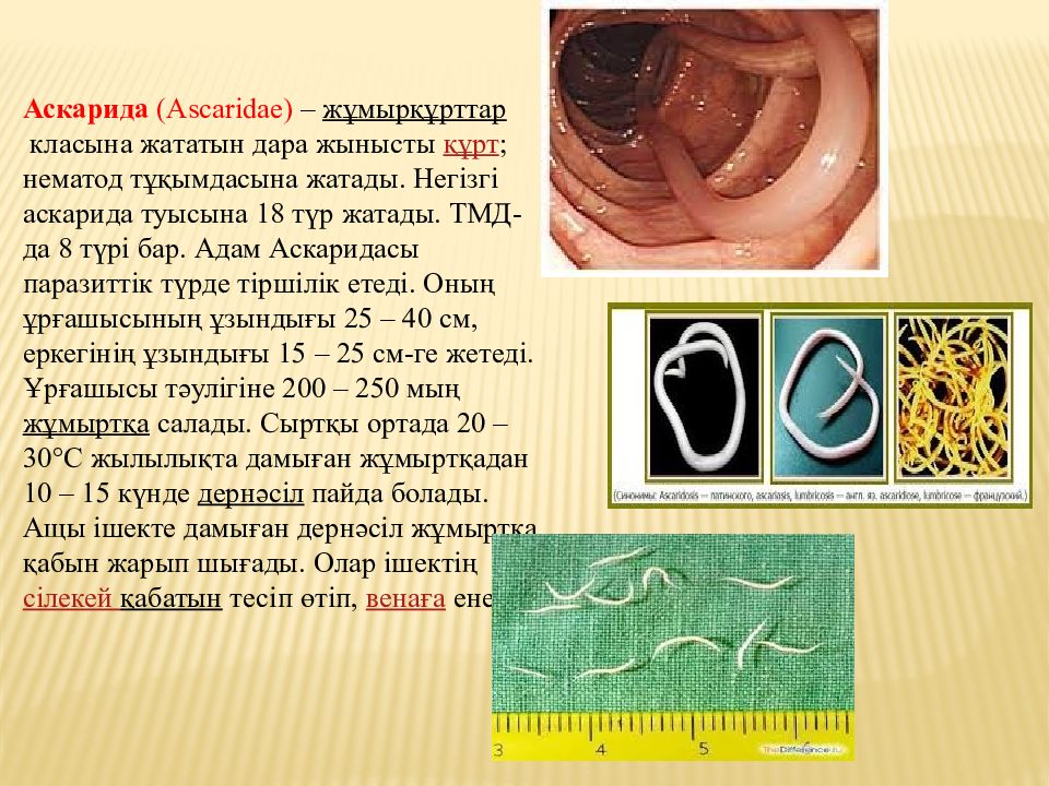 Аскариды симптомы. Классификация аскариды человеческой. Человеческая аскарида сообщение. Аскарида человеческая вред. Место обитания человеческой аскариды.