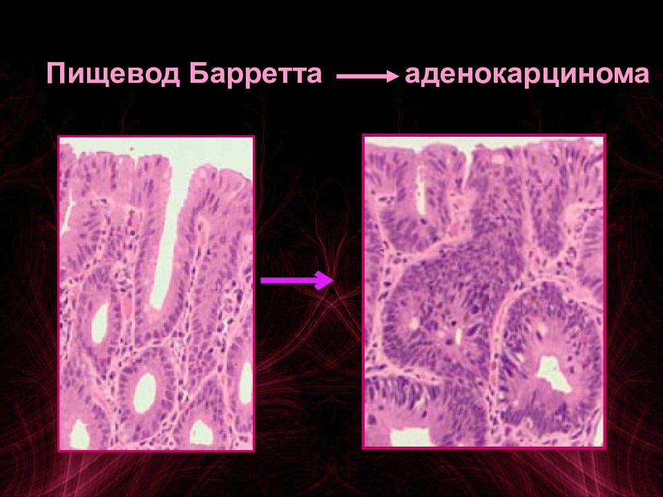 Патофизиология опухолевого роста презентация