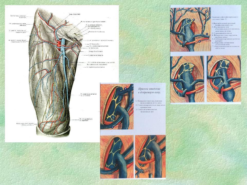 Операции на нервах сухожилиях. Вена артерия нерв Ваня. Операции на кровеносных сосудах нервах и сухожилиях конечностей. Операции на кровеносных сосудах конечностей.