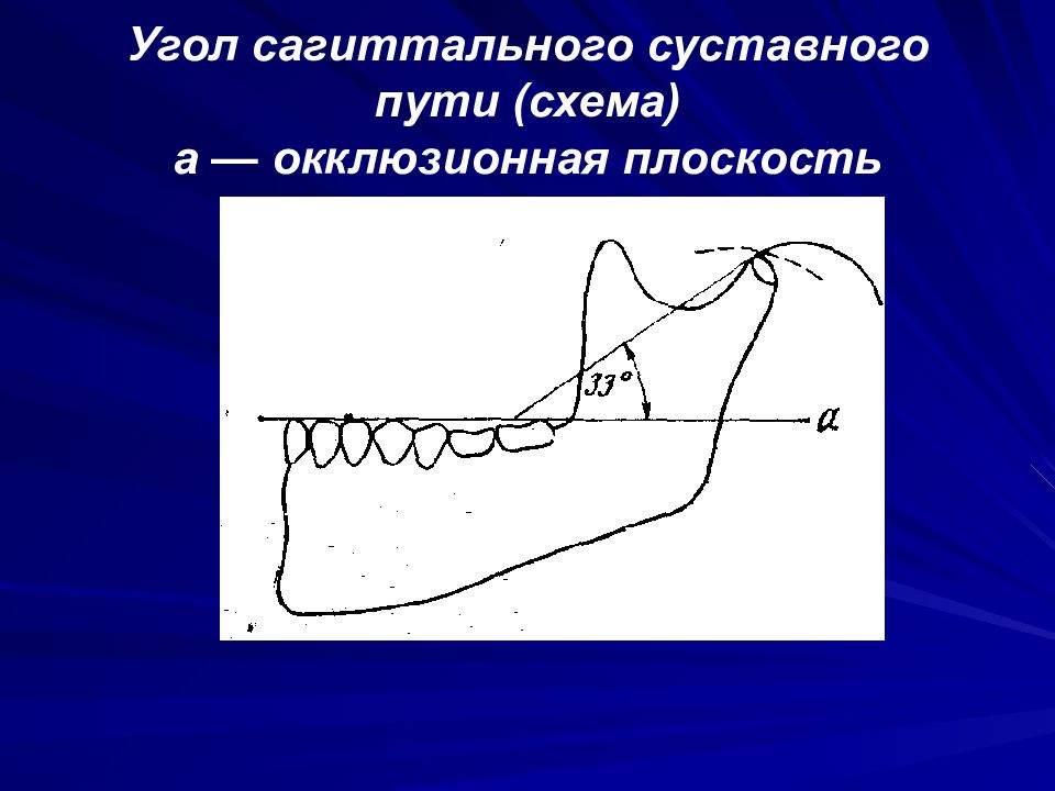 Угол пути. Сагиттальный суставной путь. Угол сагиттального суставного и резцового пути. Сагиттальные движения нижней челюсти.