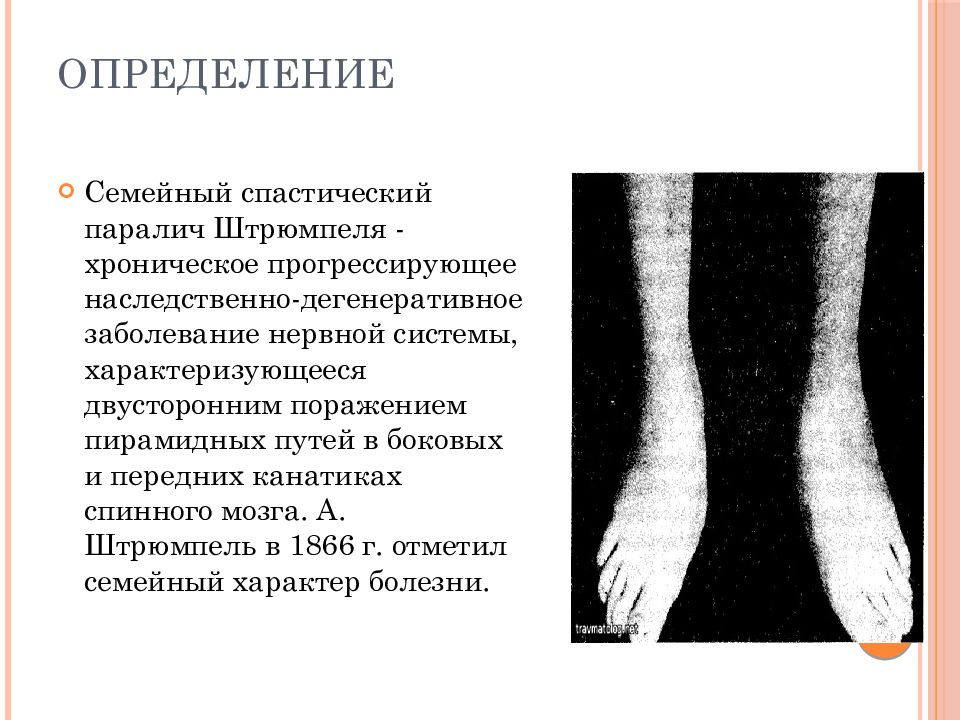 Штрюмпеля болезнь презентация