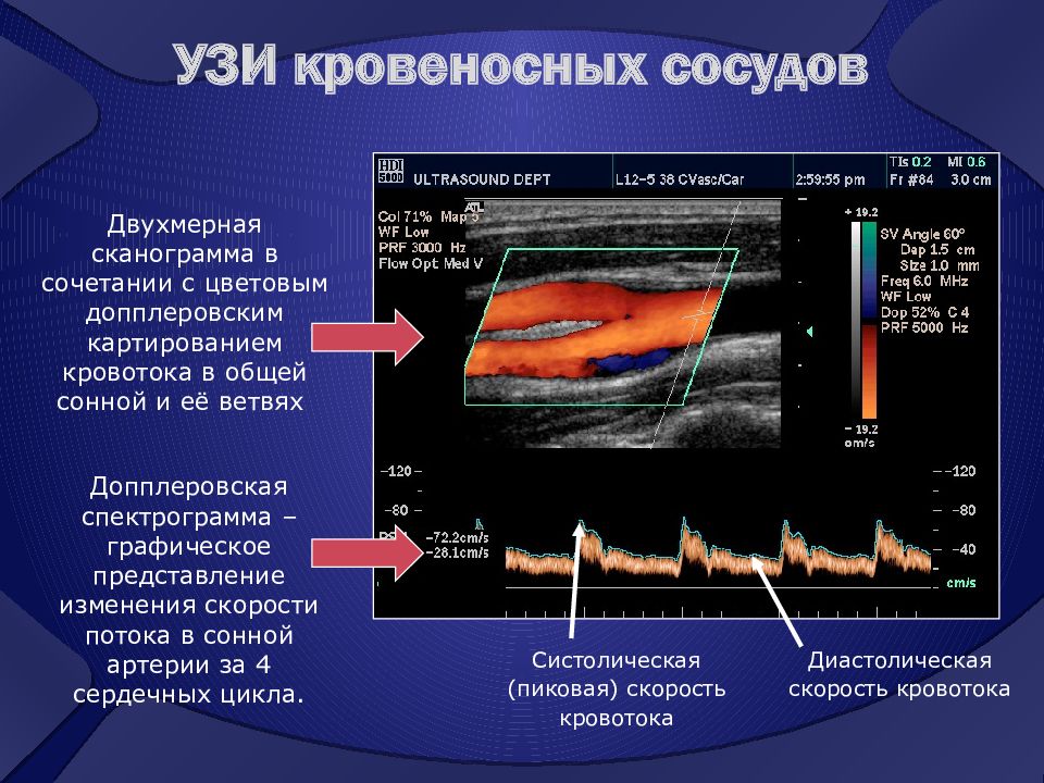 Ультразвуковое исследование презентация