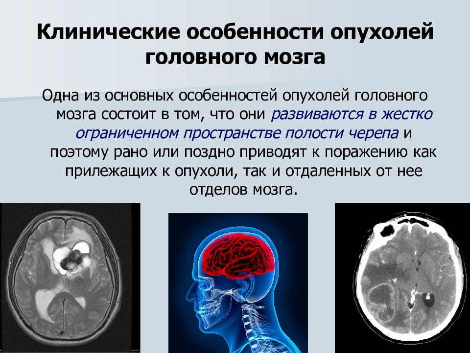 Диагностика опухолей головного мозга презентация