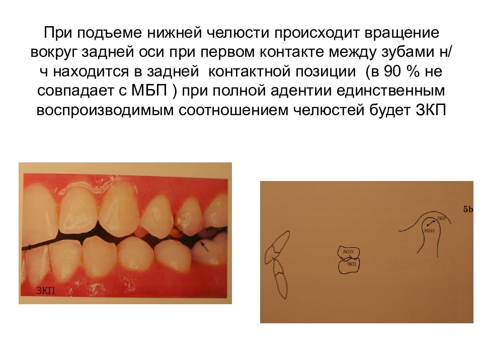 Артикуляция и окклюзия