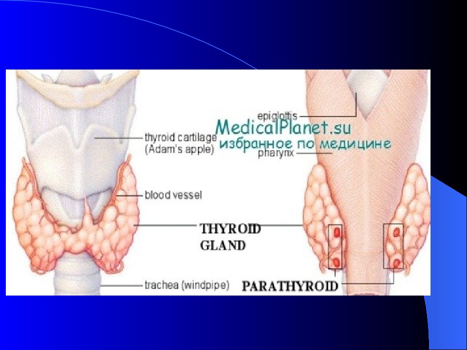 Гипофункция паращитовидной железы