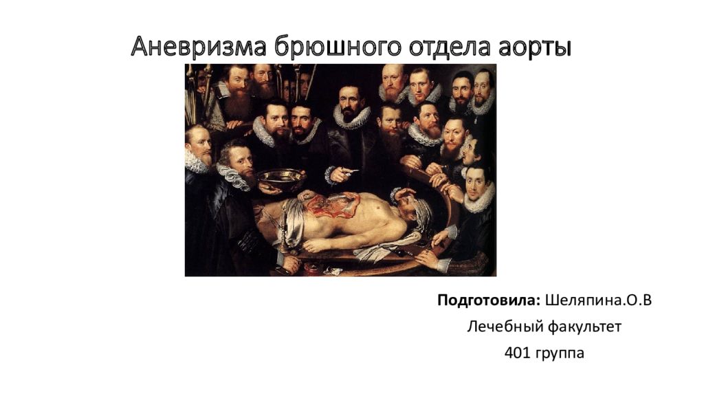 Аневризма брюшного отдела аорты