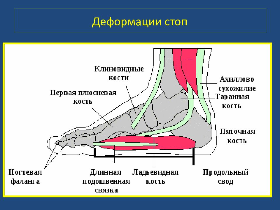 Болезни стопы человека схема обозначение связок и костей