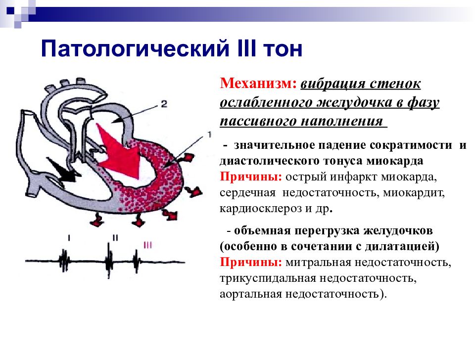 Особенность аускультативной картины сердца у детей тест с ответами