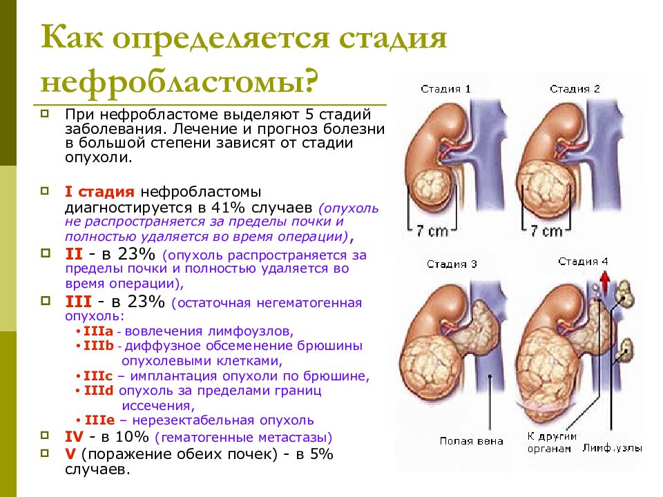 Картинки для презентации опухоль