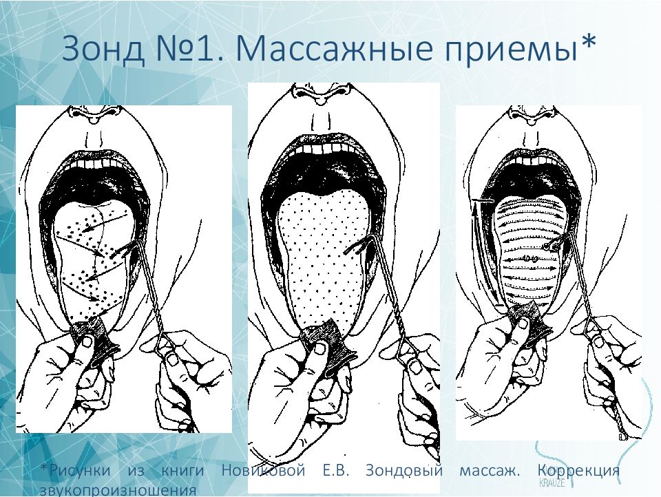 Логопедический массаж презентация