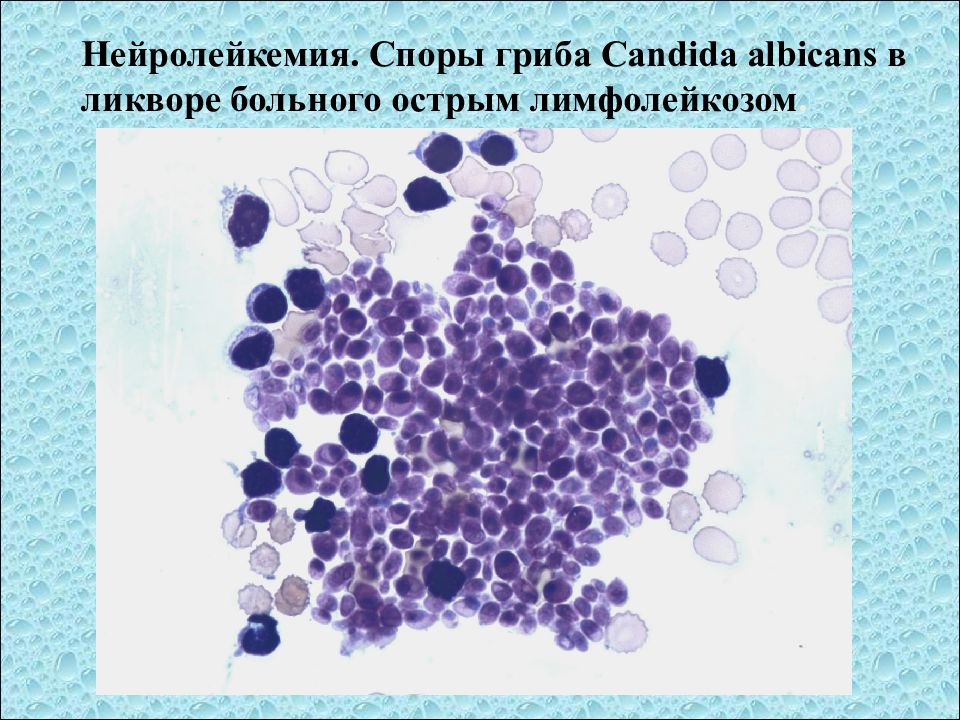 Исследование ликвора презентация