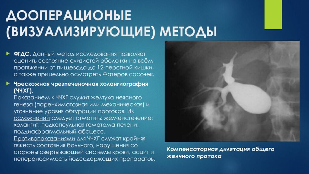 ДООПЕРАЦИОНЫЕ (ВИЗУАЛИЗИРУЮЩИЕ) МЕТОДЫ