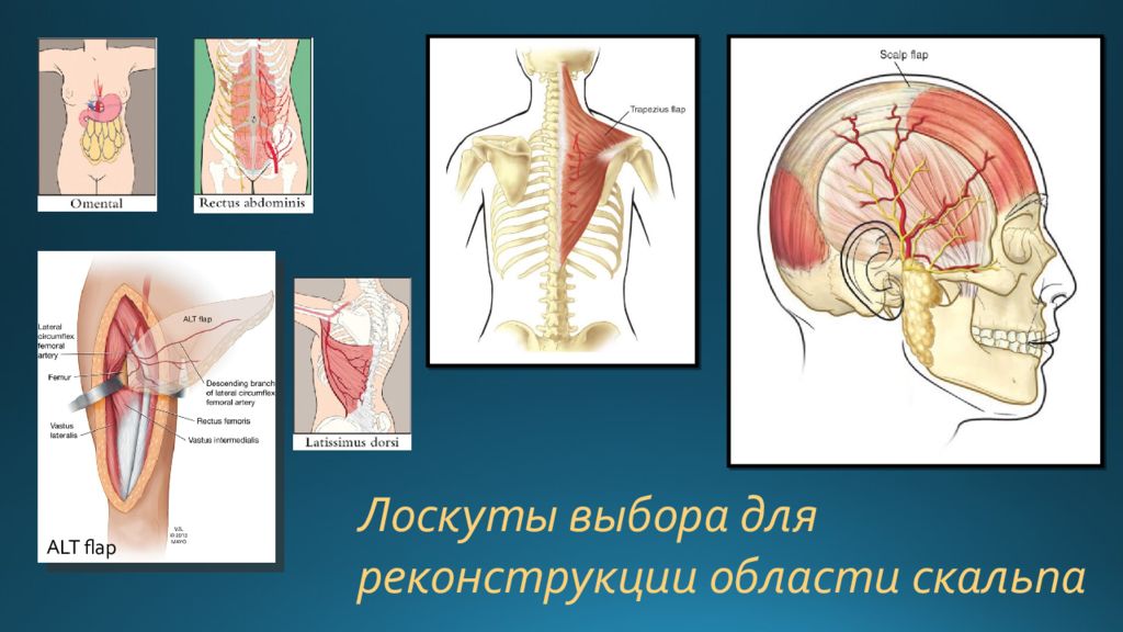 Оперативная хирургия головы и шеи презентация