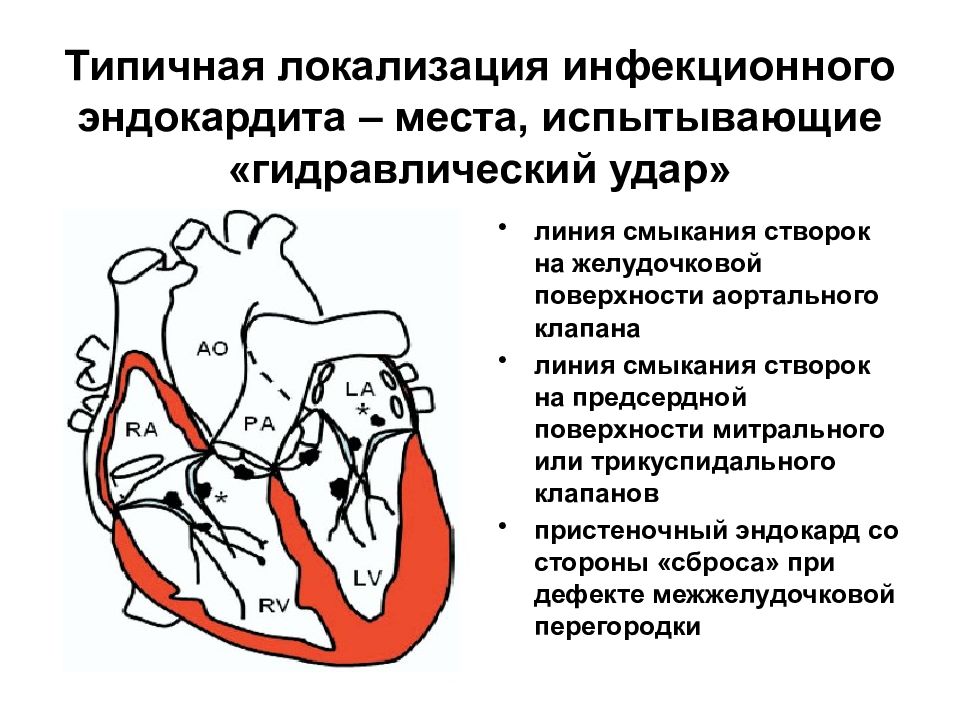 Инфекционный эндокардит терапия презентация