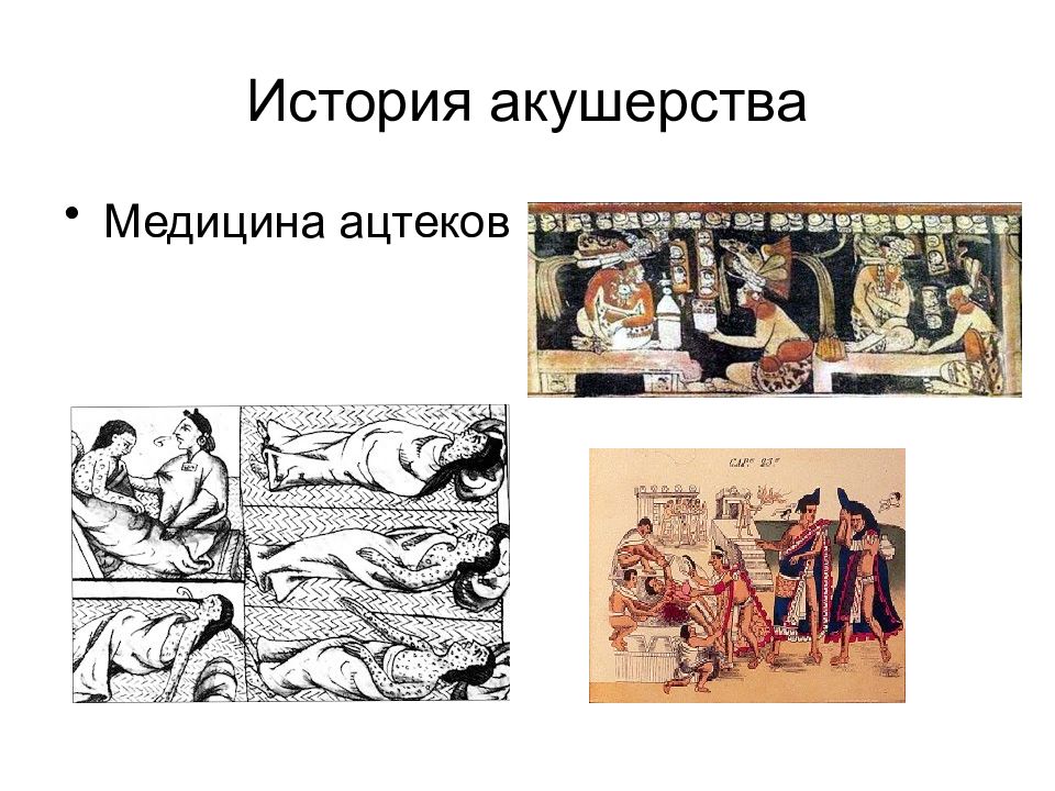 История акушерства презентация