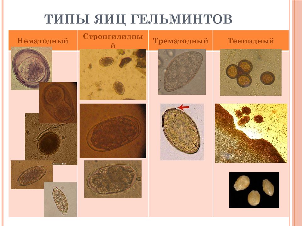 Яйца гельминтов. Коричневые яйца гельминтов. Виды яиц гельминтов.