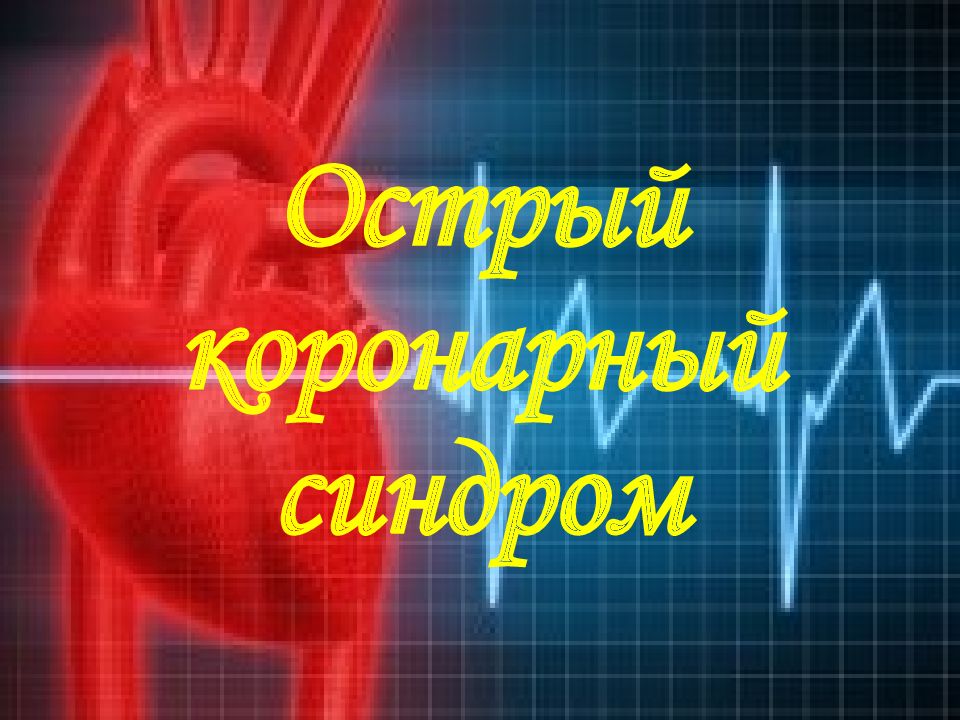 Острый коронарный синдром