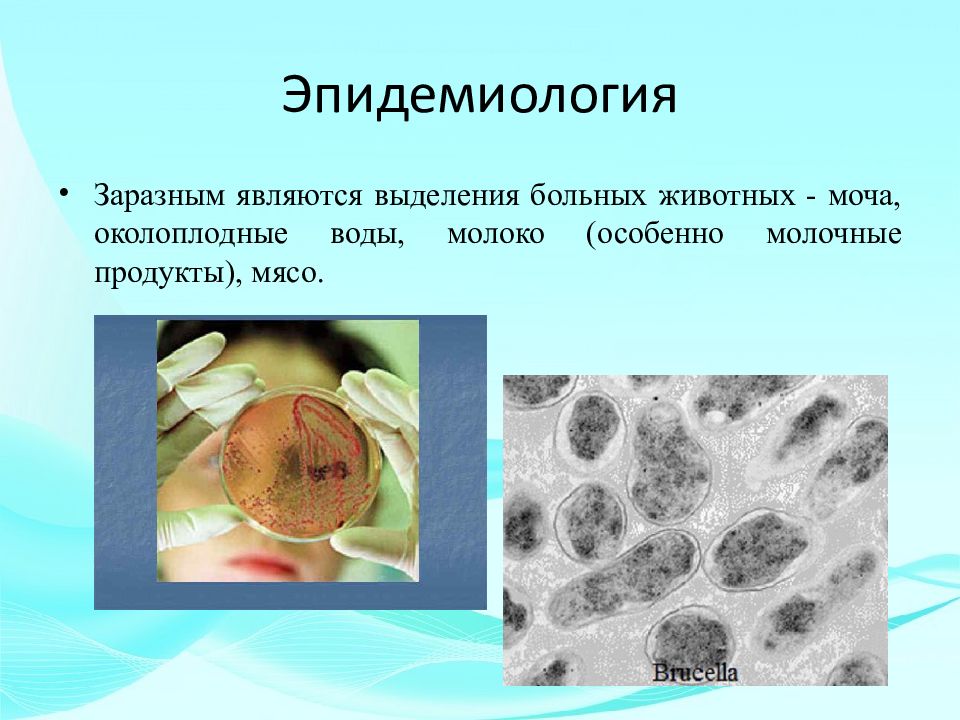 Бруцеллез картинки для презентации