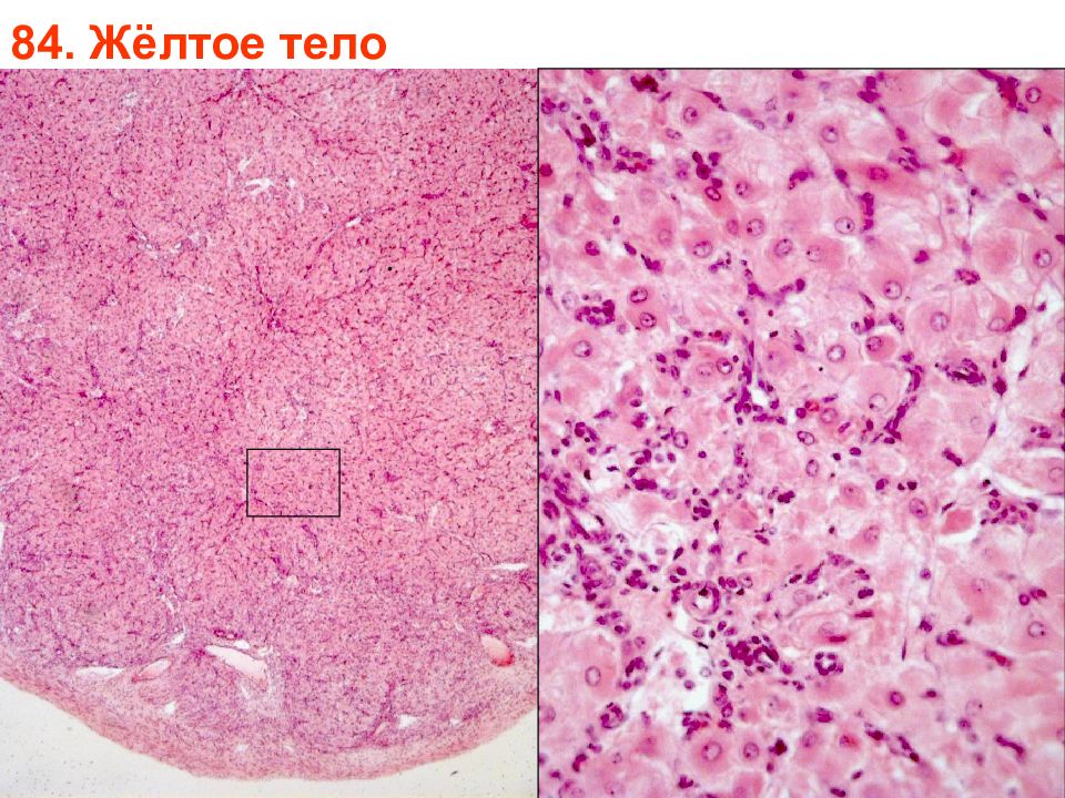 Тела препарат. Жёлтое тело в яичнике гистология препарат. Желтое тело яичника гистология. Яичник гистология препарат. Желтое Телл гистологияпрепарат.