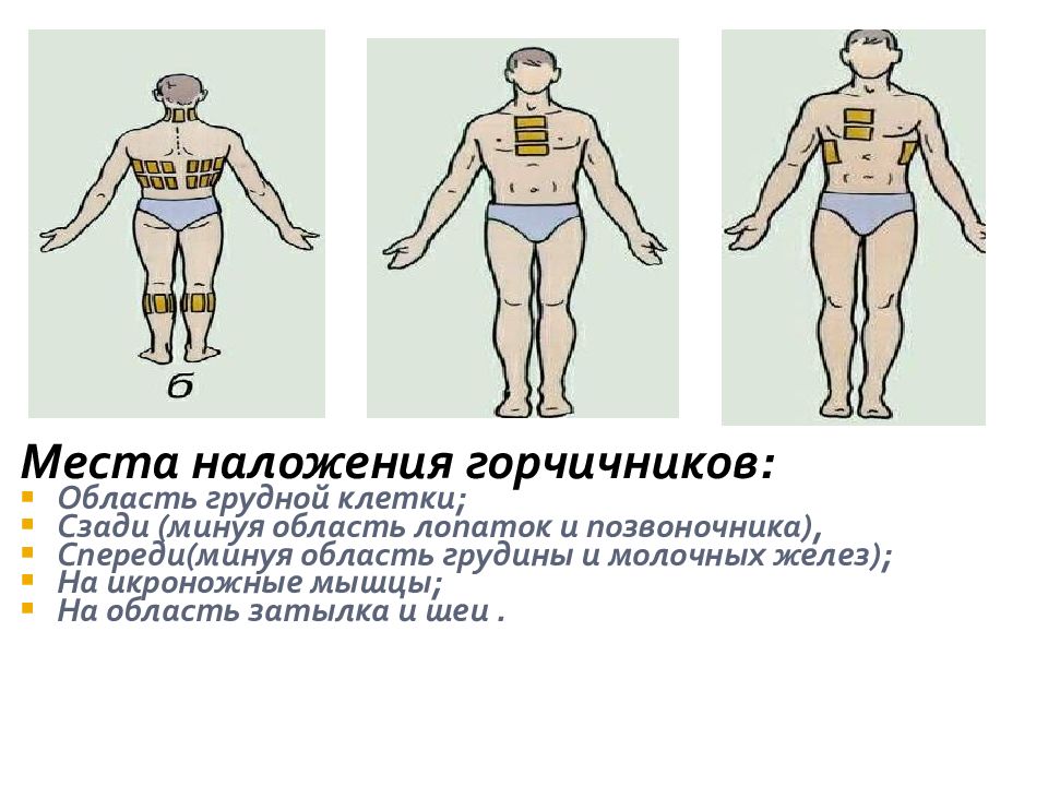 Схема как ставить горчичники