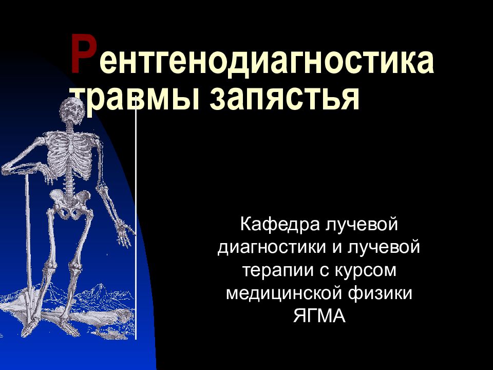 Р ентгенодиагностика травмы запястья