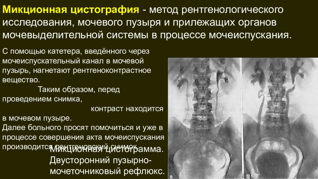 Инструментальные методы исследования мочевыделительной системы презентация