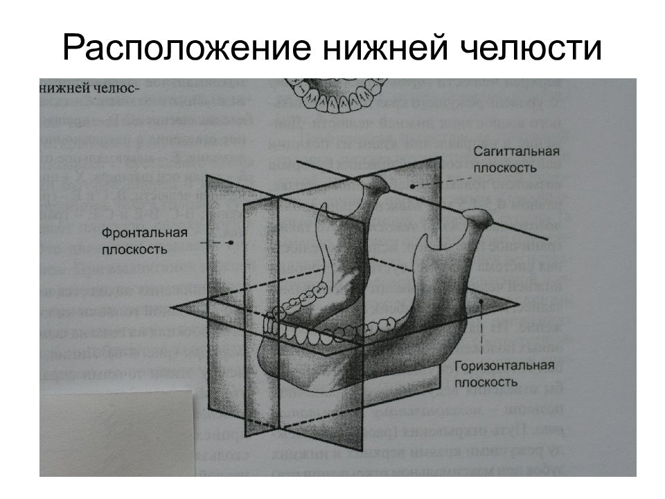 Вариант зонографии позволяющий получить развернутое плоскостное изображение челюстей