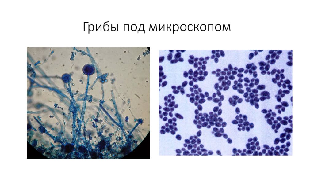 Грибы микробиология. Морфология грибов гифальные дрожжевые микробиология. Грибы под микроскопом микробиология. Микробы грибы.