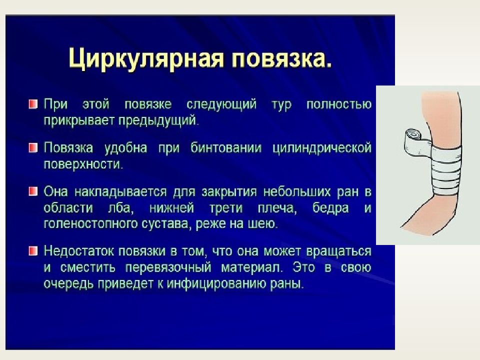 Процесс повторного наложения повязки на рану называют. Циркулярная повязка на конечность. Десмургия повязки. Бинтовые повязки.