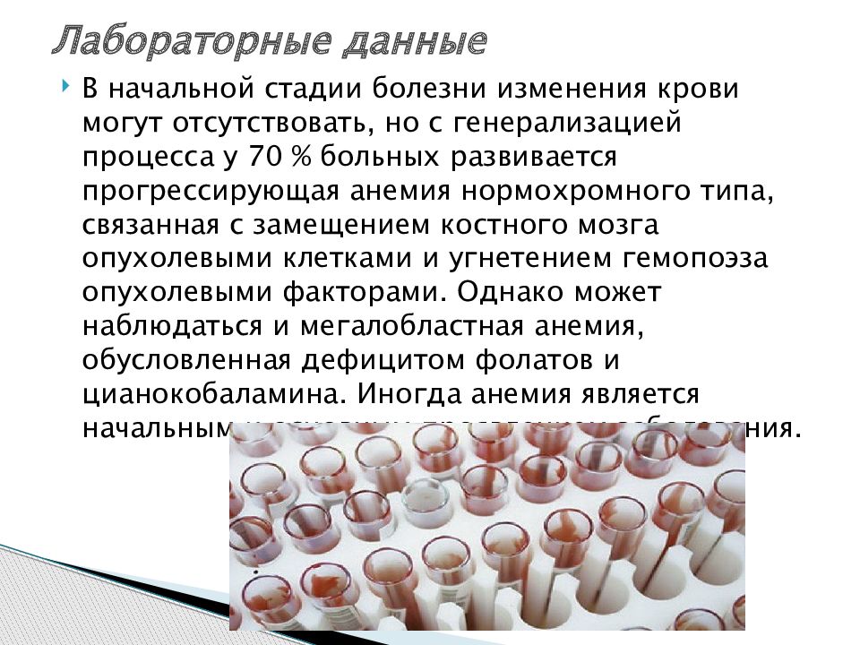 Миеломная болезнь презентация