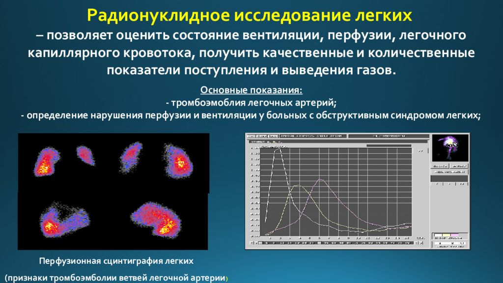 Методы лучевой диагностики органов дыхания презентация