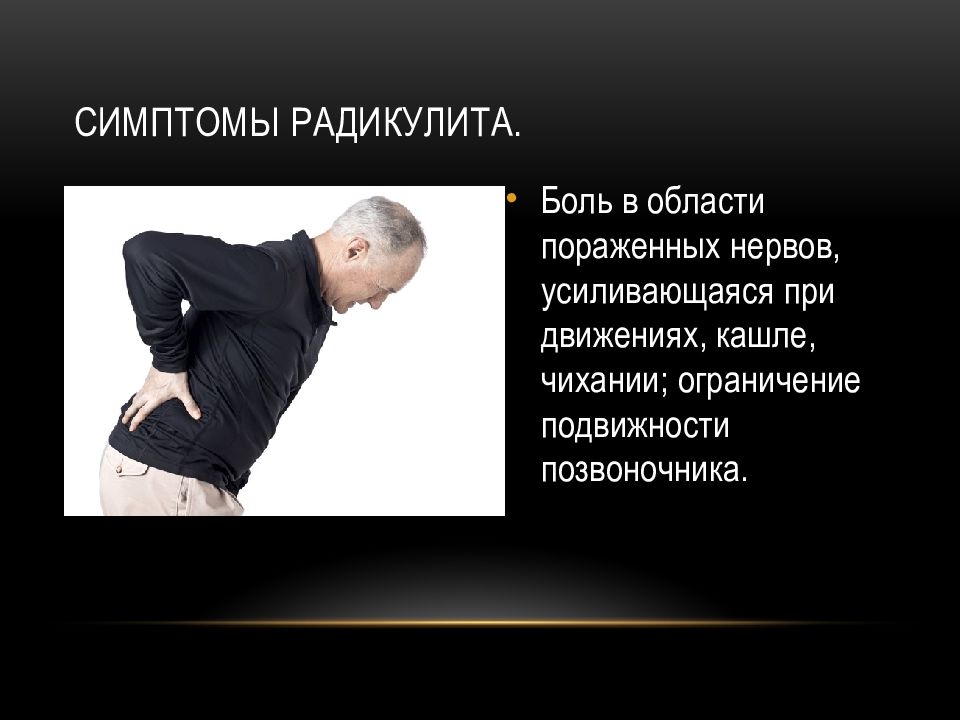 Радикулит крестцового отдела. При пояснично. Радикулит пояснично крестцовый симптомы. Крестцовый. Признаки заболевания радикулитом.