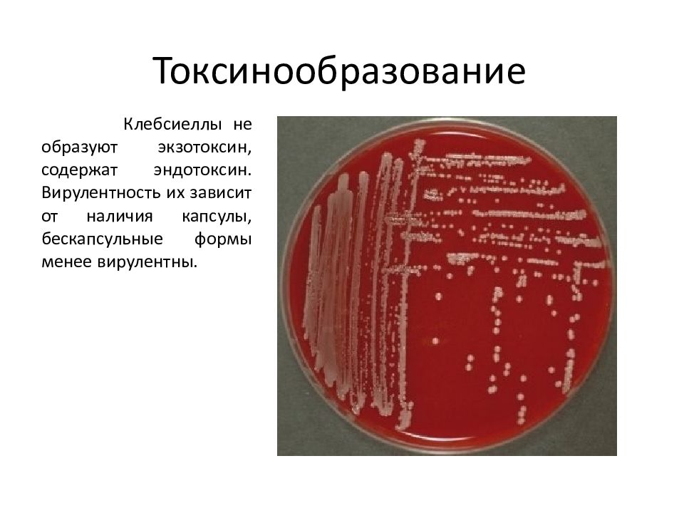 Klebsiella pneumoniae 10 5