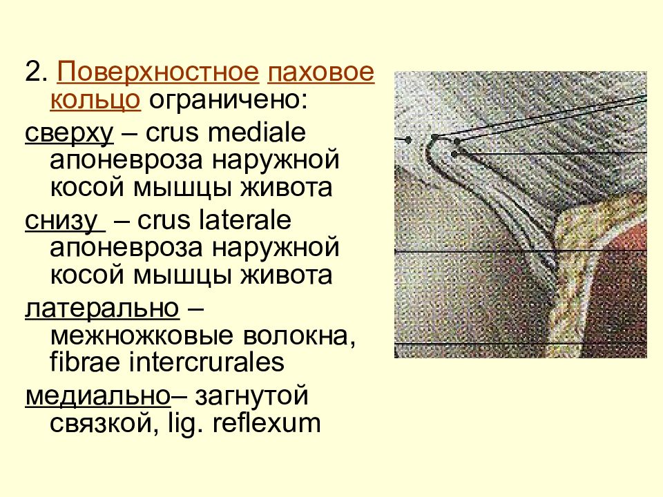 Поверхностное паховое. Снизу поверхностное кольцо пахового канала образовано. Поверхностное паховое кольцо. Поверхностное паховое кольцо ограничено. Поверхностное кольцо пахового канала.